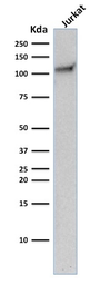 Anti-CD31 antibody [C31.10] used in Western Blot (WB). GTX34493