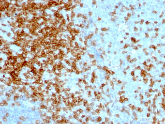 Anti-CD43 antibody [84-3C1] used in IHC (Paraffin sections) (IHC-P). GTX34509