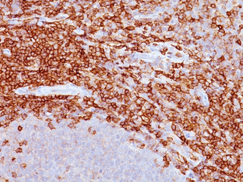 Anti-CD43 antibody [DF-T1] used in IHC (Paraffin sections) (IHC-P). GTX34513