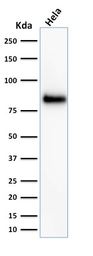 Anti-CD44 antibody [HCAM/918] used in Western Blot (WB). GTX34516