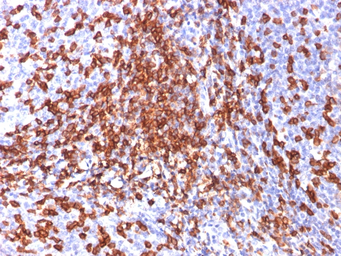 Anti-CD44 antibody [156-3C11] used in IHC (Paraffin sections) (IHC-P). GTX34519