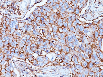 Anti-CD44 antibody [156-3C11] used in IHC (Paraffin sections) (IHC-P). GTX34519
