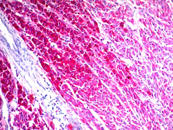 Anti-CD63 antibody [NKI/C3] used in IHC (Paraffin sections) (IHC-P). GTX34538