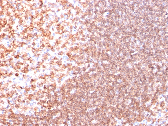 Anti-CD74 antibody [SPM523] used in IHC (Paraffin sections) (IHC-P). GTX34552