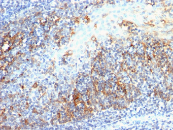 Anti-CDC20 antibody [AR12] used in IHC (Paraffin sections) (IHC-P). GTX34578