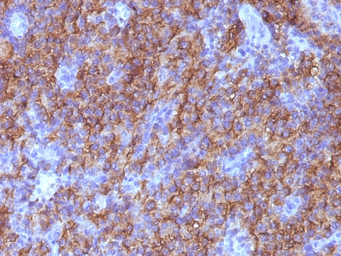 Anti-Chromogranin A antibody [CHGA/765] used in IHC (Paraffin sections) (IHC-P). GTX34597