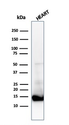 Anti-Cytochrome C antibody [CTC05] used in Western Blot (WB). GTX34620