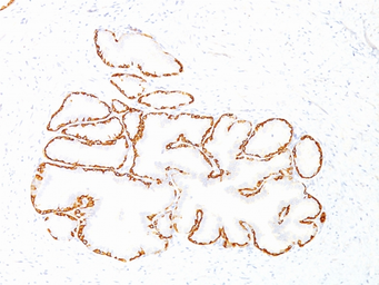 Anti-Cytokeratin 14 antibody [SPM263] used in IHC (Paraffin sections) (IHC-P). GTX34629