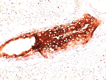 Anti-Cytokeratin 17 antibody [SPM560] used in IHC (Paraffin sections) (IHC-P). GTX34635