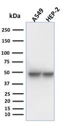 Anti-Cytokeratin 18 antibody [KRT18/1190] used in Western Blot (WB). GTX34637