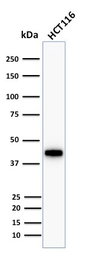 Anti-Cytokeratin 18 antibody [KRT18/1190] used in Western Blot (WB). GTX34637