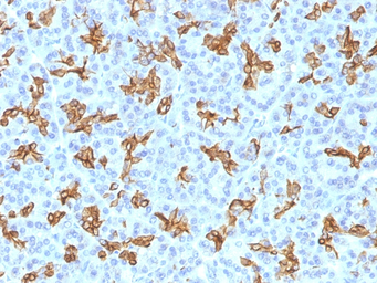 Anti-Cytokeratin 19 antibody [KRT19/800] used in IHC (Paraffin sections) (IHC-P). GTX34651