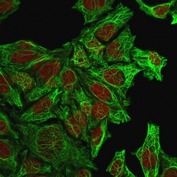 Anti-Cytokeratin 7 antibody [KRT7/760] used in Immunocytochemistry/ Immunofluorescence (ICC/IF). GTX34659