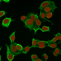 Anti-Cytokeratin 8 antibody [H1] used in Immunocytochemistry/ Immunofluorescence (ICC/IF). GTX34663