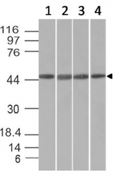 Anti-EMI1 antibody [EMI1/1176] used in Western Blot (WB). GTX34689