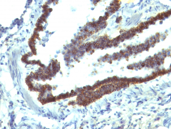 Anti-EpCAM antibody [EGP40/1110] used in IHC (Paraffin sections) (IHC-P). GTX34691
