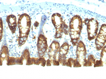 Anti-EpCAM antibody [EGP40/1110] used in IHC (Paraffin sections) (IHC-P). GTX34691