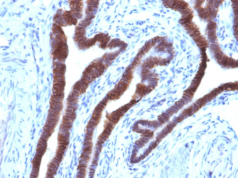 Anti-EpCAM antibody [EGP40/1110] used in IHC (Paraffin sections) (IHC-P). GTX34691
