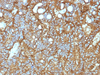Anti-EpCAM antibody [EGP40/1372] used in IHC (Paraffin sections) (IHC-P). GTX34694