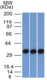 Anti-EpCAM antibody [EGP40/1372] used in Western Blot (WB). GTX34694