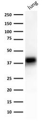 Anti-EpCAM antibody [EGP40/1372] used in Western Blot (WB). GTX34694