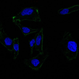 Anti-EpCAM antibody [EGP40/837] used in Immunocytochemistry/ Immunofluorescence (ICC/IF). GTX34705