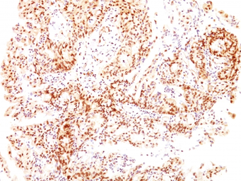 Anti-Estrogen Receptor beta antibody [ESR2/686] used in IHC (Paraffin sections) (IHC-P). GTX34712