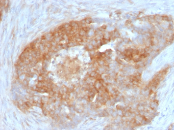 Anti-Fascin 1 antibody [FSCN1/417] used in IHC (Paraffin sections) (IHC-P). GTX34718