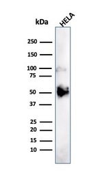 Anti-FOXA1 antibody [FOXA1/1241] used in Western Blot (WB). GTX34735