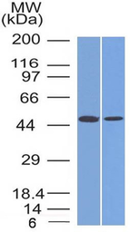 Anti-FOXA1 antibody [FOXA1/1512] used in Western Blot (WB). GTX34736