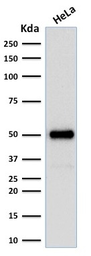 Anti-FOXA1 antibody [FOXA1/1512] used in Western Blot (WB). GTX34736