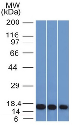 Anti-Galectin 1 antibody [GAL1/1831] used in Western Blot (WB). GTX34746