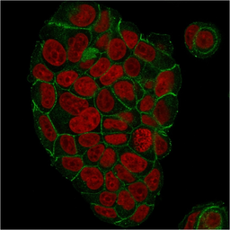 Anti-gamma Catenin antibody [CTNG/1664] used in Immunocytochemistry/ Immunofluorescence (ICC/IF). GTX34752