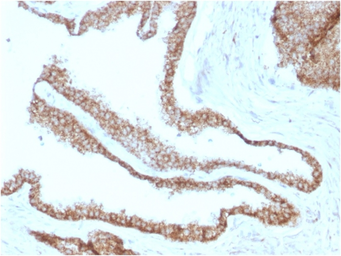 Anti-gamma Catenin antibody [CTNG/1664] used in IHC (Paraffin sections) (IHC-P). GTX34752