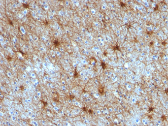 Anti-GFAP antibody [ASTRO/789] used in IHC (Paraffin sections) (IHC-P). GTX34758