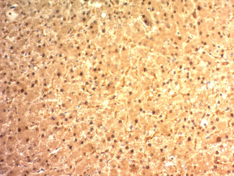 Anti-Glypican-3 antibody [SPM595] used in IHC (Paraffin sections) (IHC-P). GTX34762