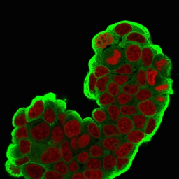 Anti-HSP27 antibody [SPM252] used in Immunocytochemistry/ Immunofluorescence (ICC/IF). GTX34782