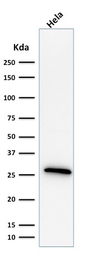 Anti-HSP27 antibody [G3.1] used in Western Blot (WB). GTX34784