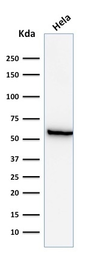 Anti-HSP60 antibody [GROEL/730] used in Western Blot (WB). GTX34787