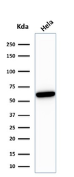 Anti-HSP60 antibody [HSPD1/780] used in Western Blot (WB). GTX34788