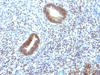 Anti-MAP3K1 antibody [2F6] used in IHC (Paraffin sections) (IHC-P). GTX34816