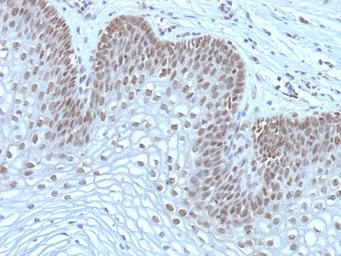 Anti-MAP3K1 antibody [2F6] used in IHC (Paraffin sections) (IHC-P). GTX34816