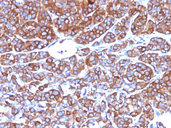 Anti-Moesin antibody [MSN/492] used in IHC (Paraffin sections) (IHC-P). GTX34848