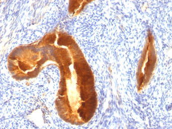 Anti-MUC1 antibody [MUC1/955] used in IHC (Paraffin sections) (IHC-P). GTX34852