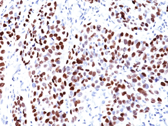 Anti-p21 Cip1 antibody [CIP1/823] used in IHC (Paraffin sections) (IHC-P). GTX34924