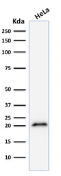 Anti-p21 Cip1 antibody [CIP1/823] used in Western Blot (WB). GTX34924