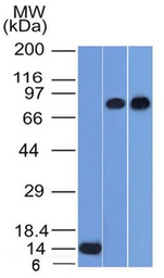 Anti-p63 antibody [TP63/1786] used in Western Blot (WB). GTX34944