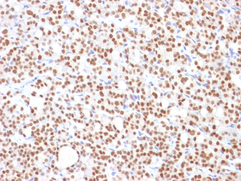 Anti-PAX8 antibody [PAX8/1492] used in IHC (Paraffin sections) (IHC-P). GTX34962