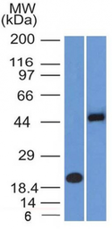 Anti-PAX8 antibody [PAX8/1492] used in Western Blot (WB). GTX34962