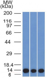 Anti-S100A4 antibody [S100A4/1481] used in Western Blot (WB). GTX34999